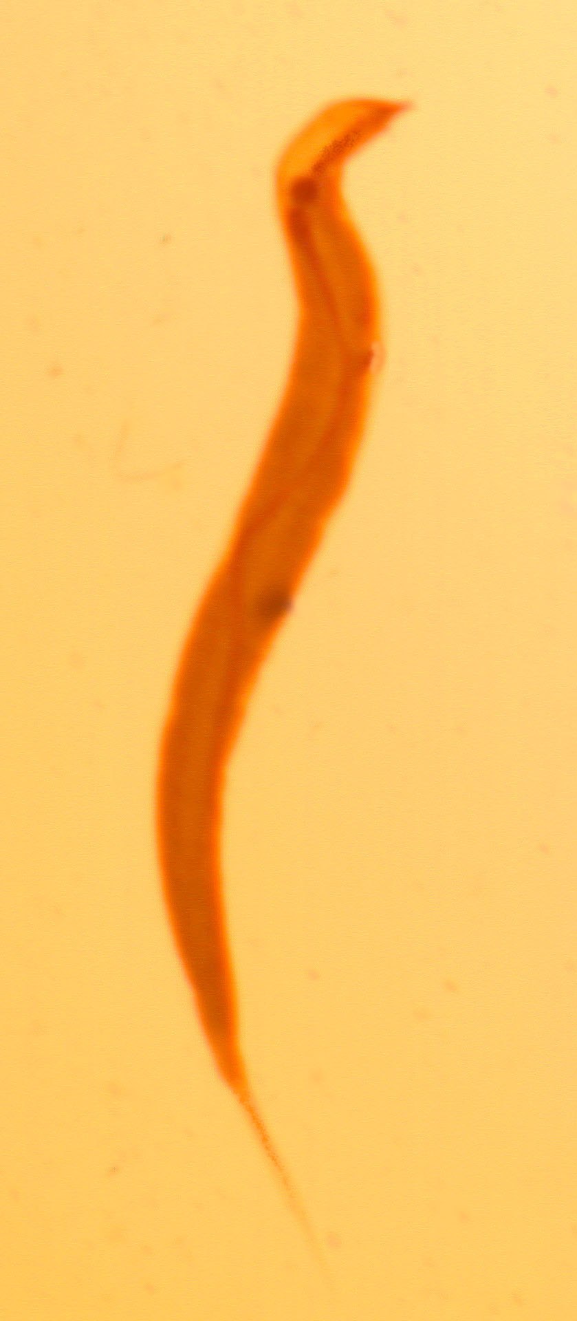 Мушмула Азербайджанская