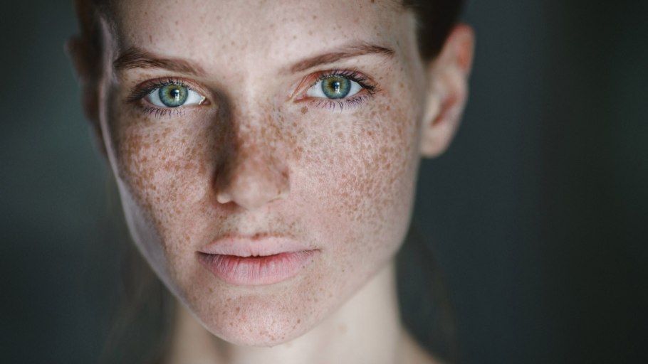Веснушки на лице