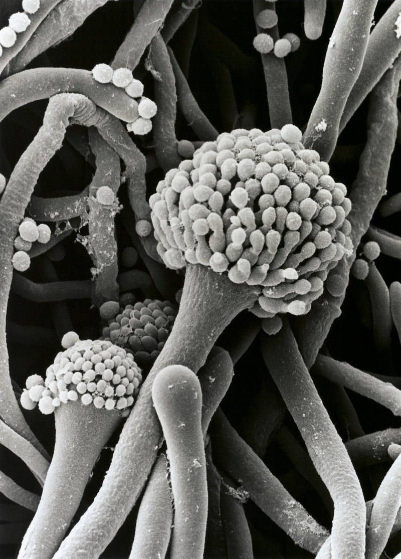 Aspergillus fumigatus микроскоп