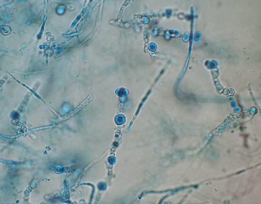 Грибок аспергиллус