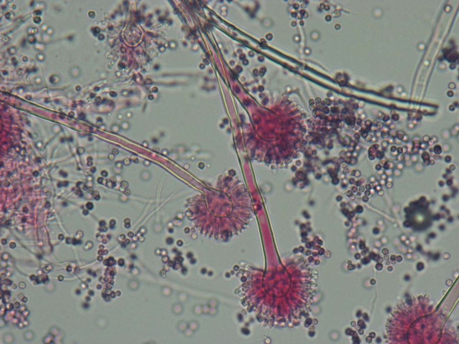 Аспергиллус микроскопия