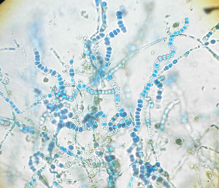 Кандида альбиканс микроскопия