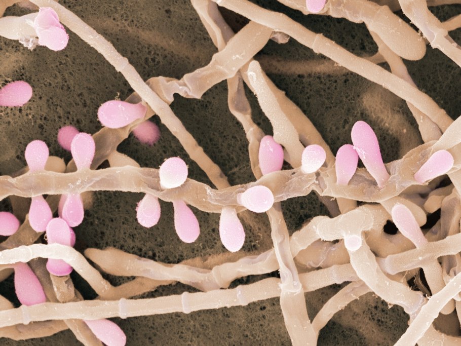 Грибок трихофитон рубрум