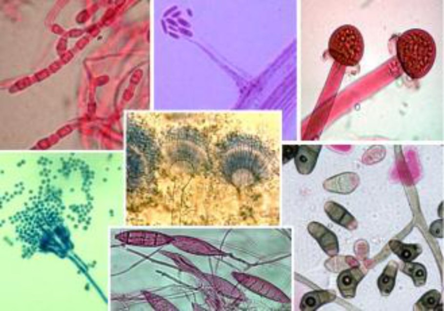 Trichophyton mentagrophytes