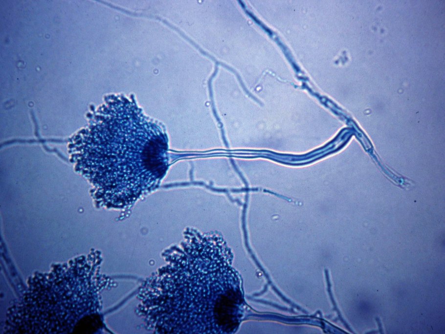 Aspergillus fumigatus микроскоп