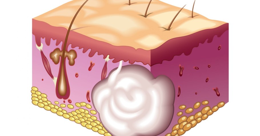 Пластинчатые грибы Лисичка