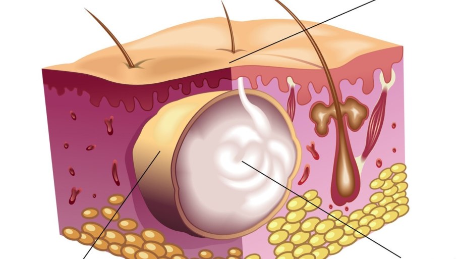 Грибы Забайкальского края