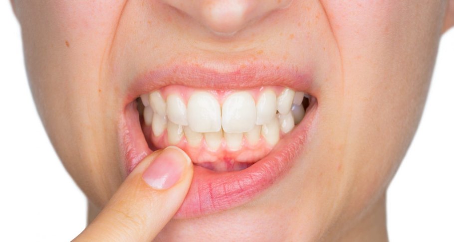 Роллиния дерево