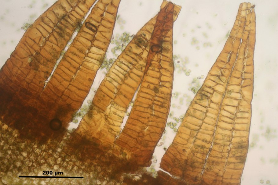 Splachnum sphaericum