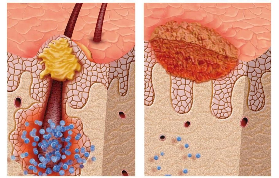 Оплодотворение яйцеклетки под микроскопом