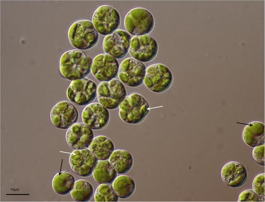 Гаустории гриба в лишайнике