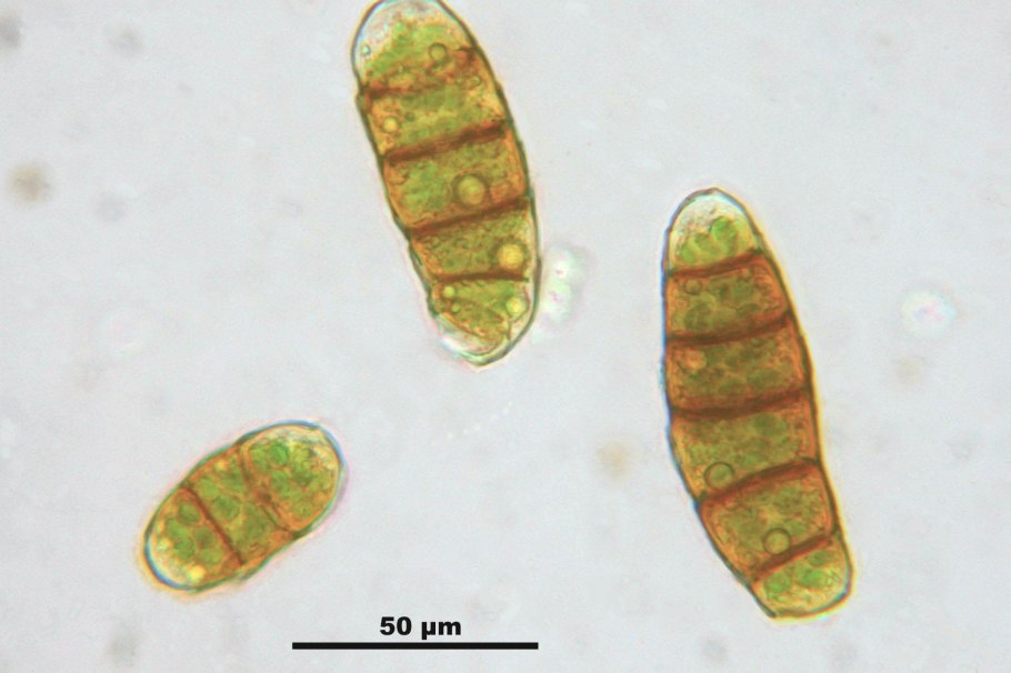 Споры bipolaris sorokiniana.