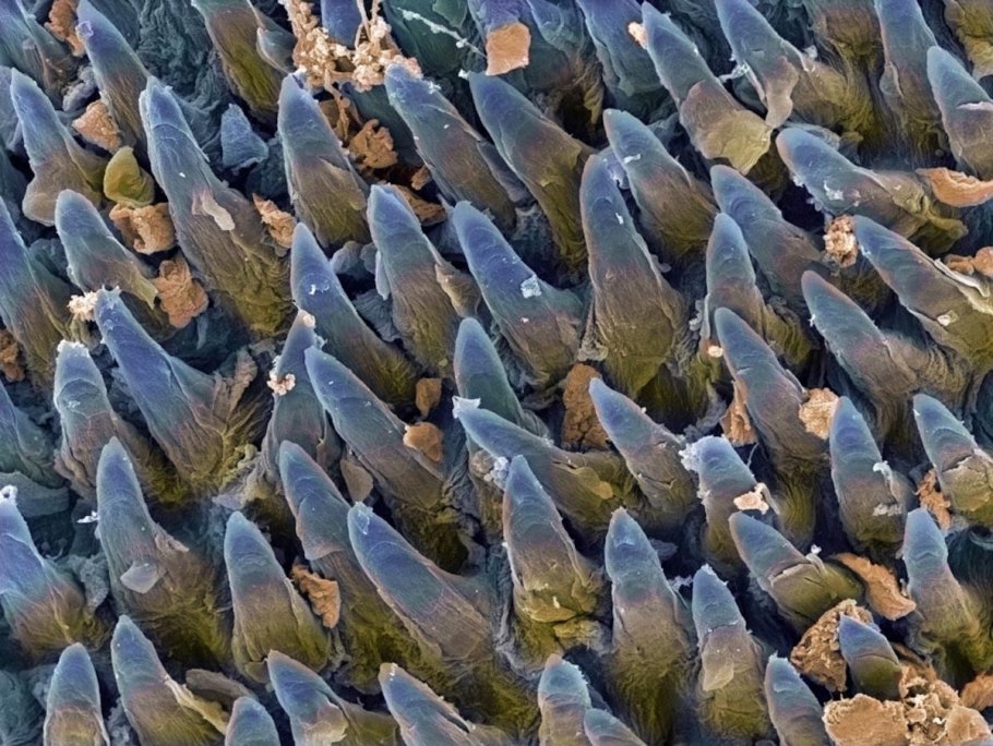 Язык под микроскопом