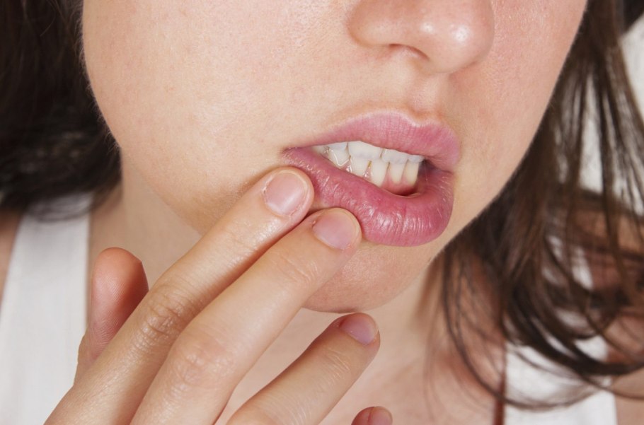 Клещ Железница (Demodex folliculorum)