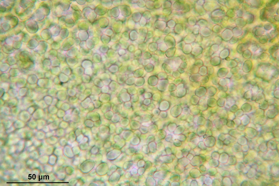 Chlorella vulgaris