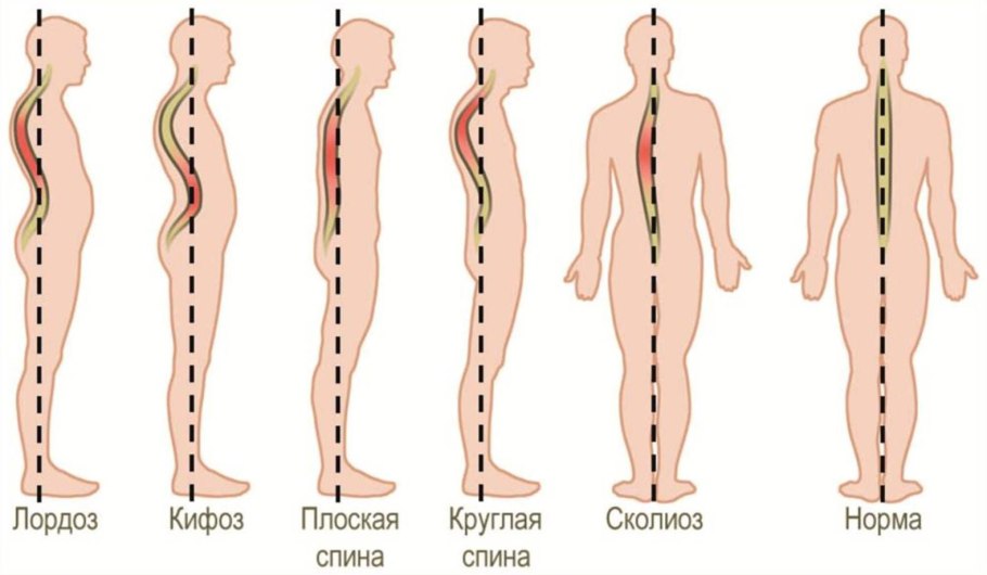 Позвоночник человека лордоз кифоз