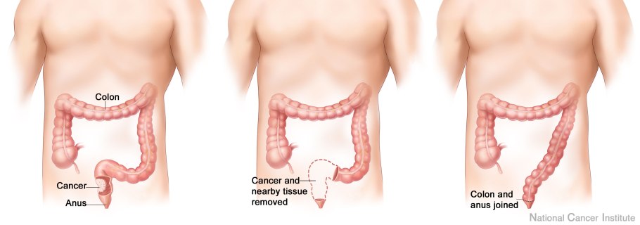 Стилус WIWU Picasso Active Stylus p339 White