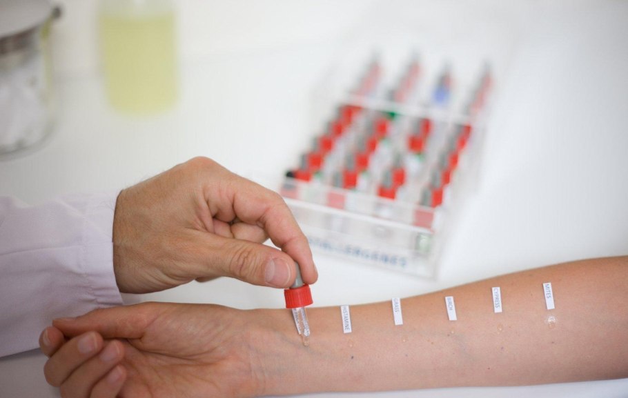 Медиальный эпикондилит