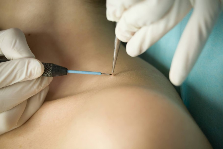 Младший медицинский персонал