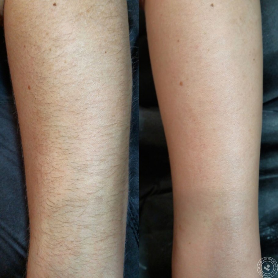 Части желтого тела