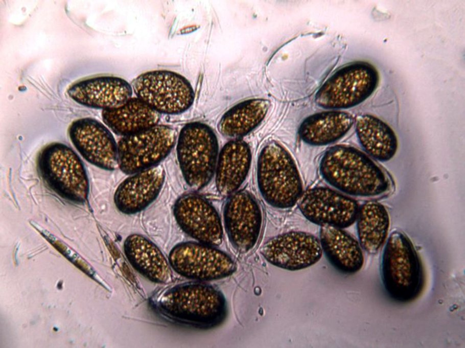 Остриопсис (Ostryopsis)