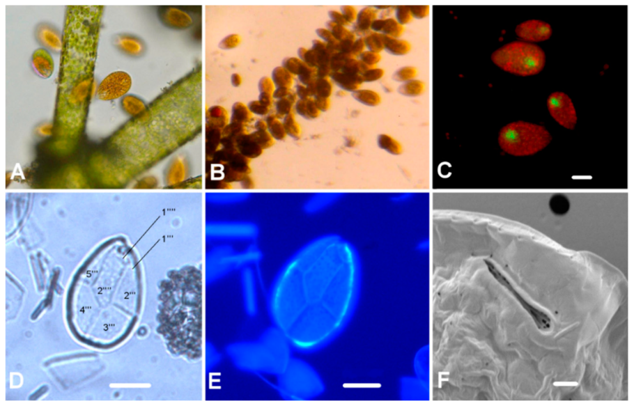 Инфузория frontonia