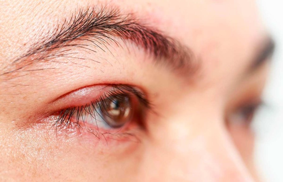 Бонафтон мазь глазная