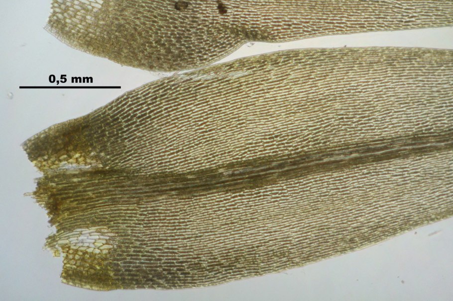 Антеридий сфагнума