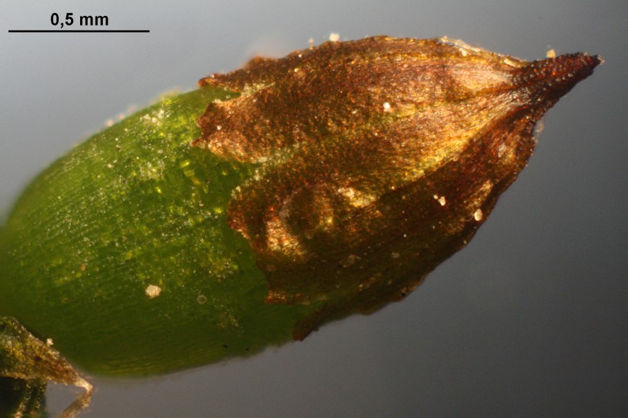 Поперечный срез листа Кукушкина льна
