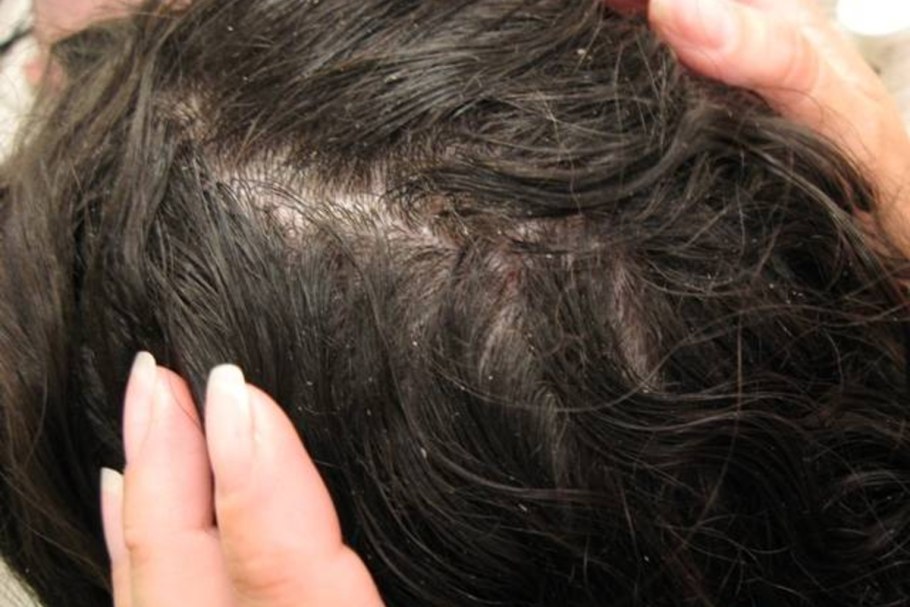 Насилие в семье над женщиной