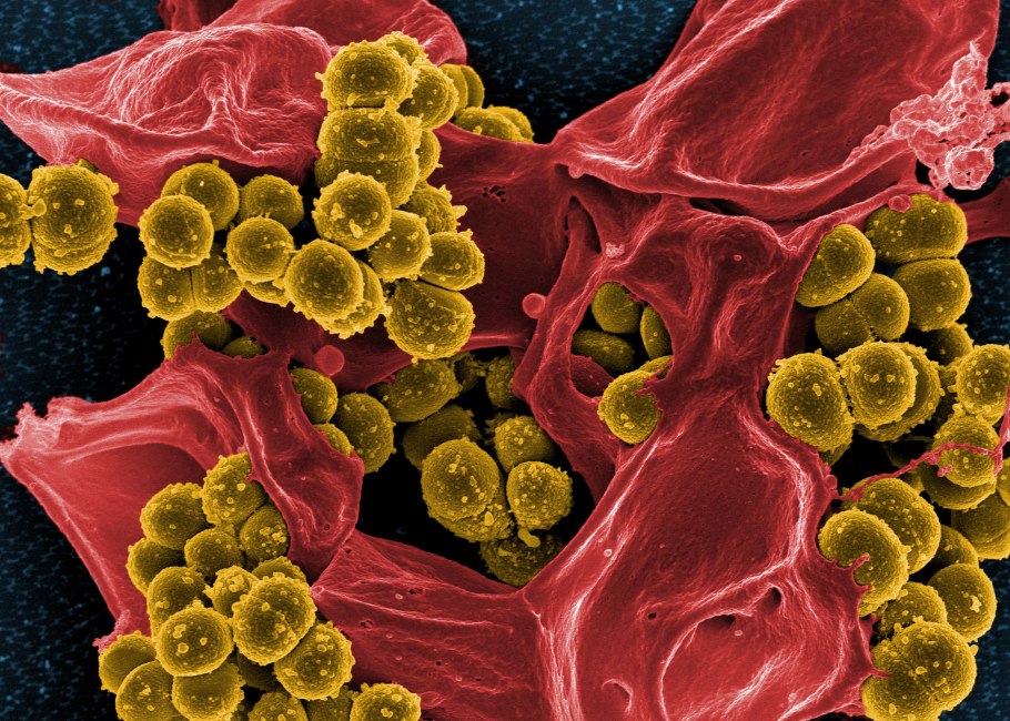 Стафилококк золотистый Staphylococcus aureus