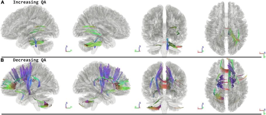 Мозолистое тело человека
