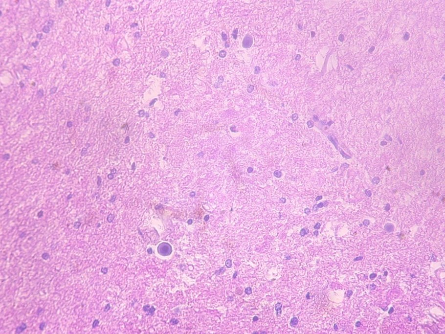 Большие мозоли на руках