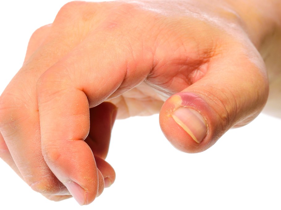 Acronychia baeuerlenii