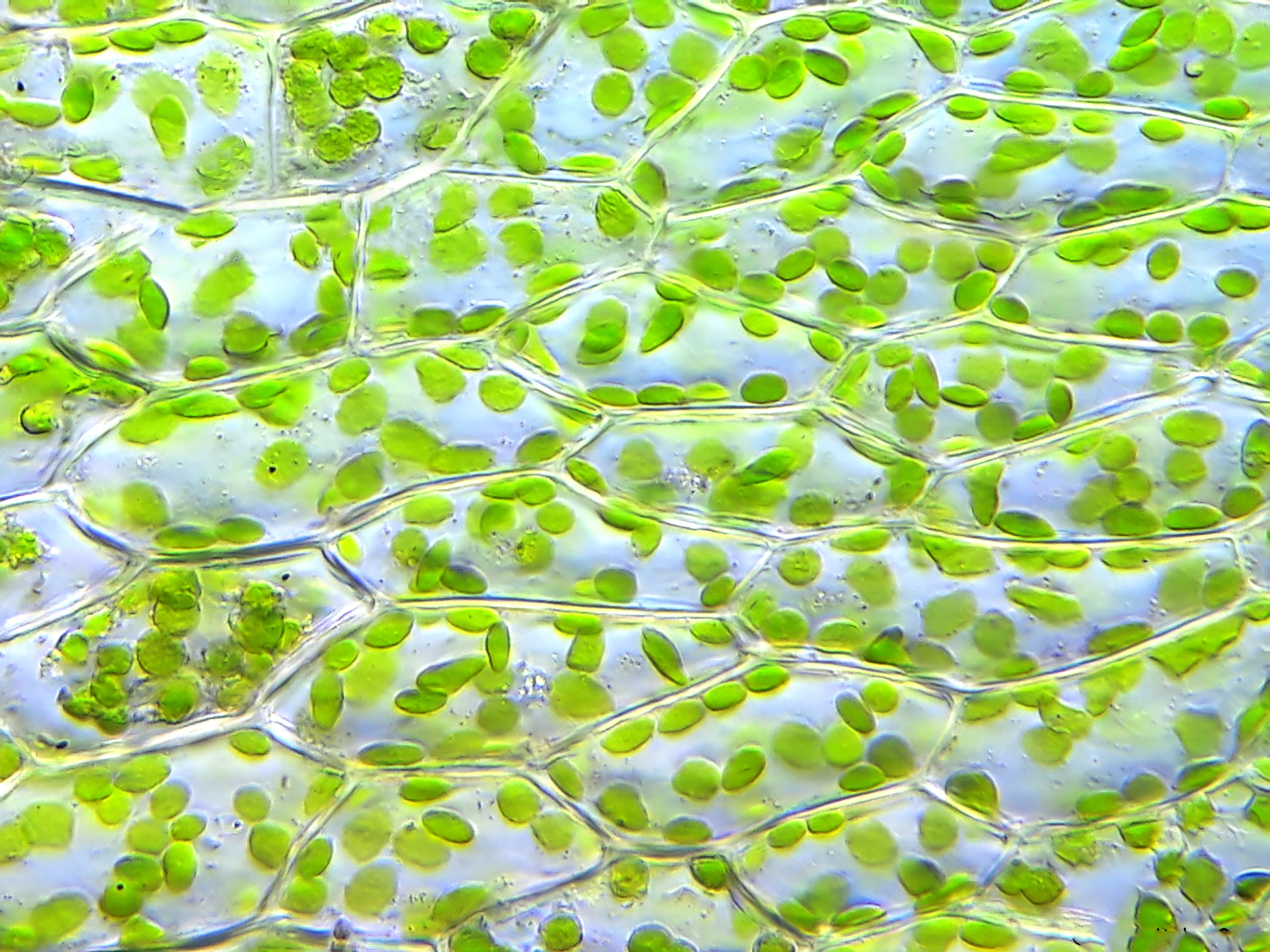 Зеленые водоросли форма. Элодея хлорофилл. Клетка элодеи хлорофилл. Хлорофилл в клетках растения. Хлоропласты элодеи.
