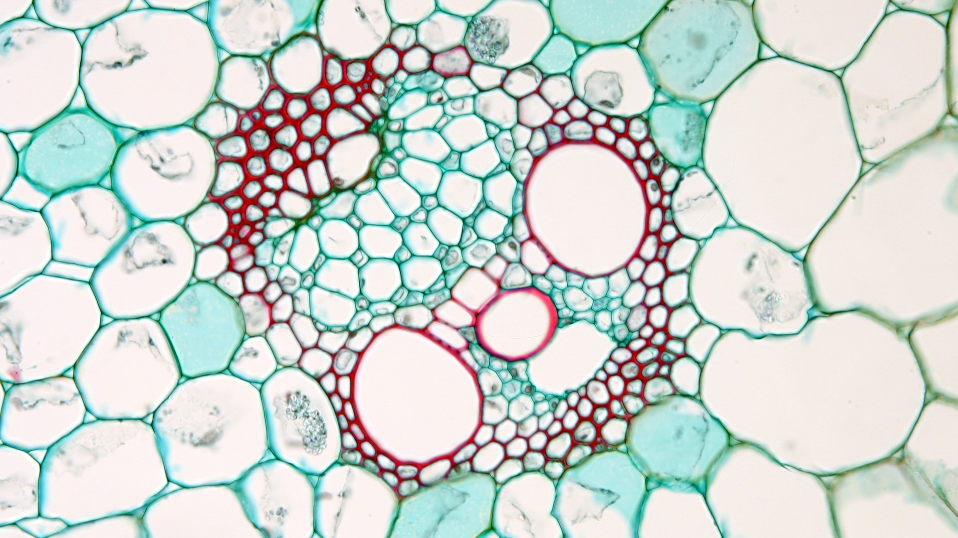 Клетка без воды. Ксилема микроскоп. Эпидерма колленхима. Колленхима ткани растений микроскоп. Механическая ткань у элодеи.