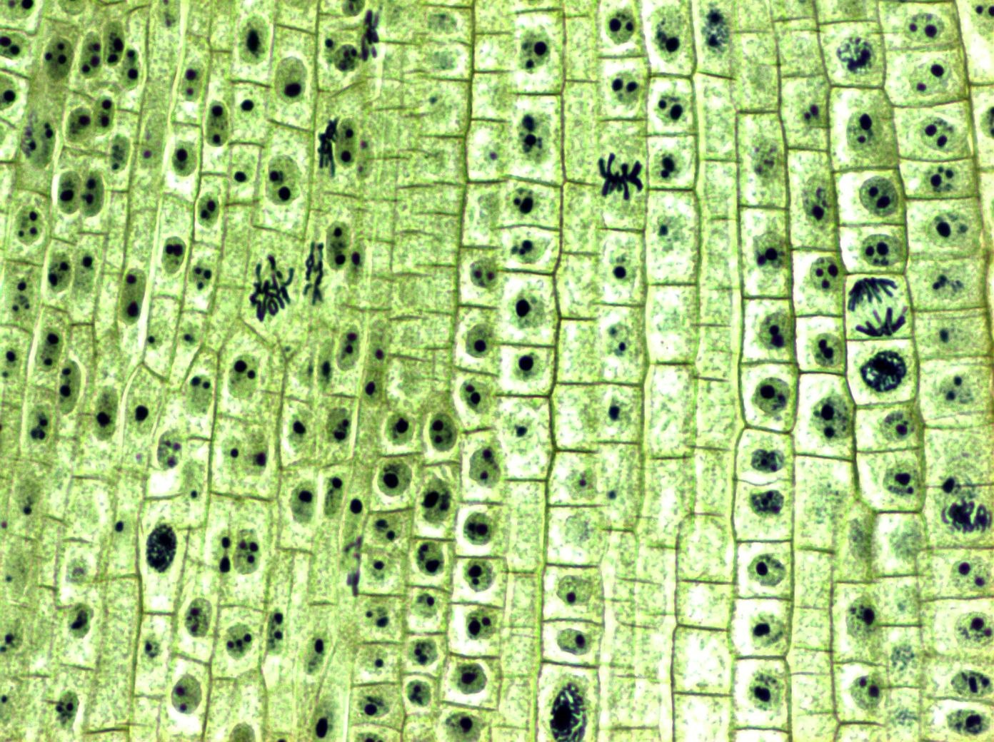 Микропрепараты ботаника. Меристема микрофотография. Меристема ткани растений. Меристема листа. Клетки меристемы растений.