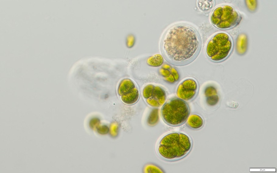 Одноклеточная водоросль хлорелла