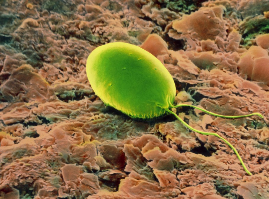 Хламидомонада Рейнгардта