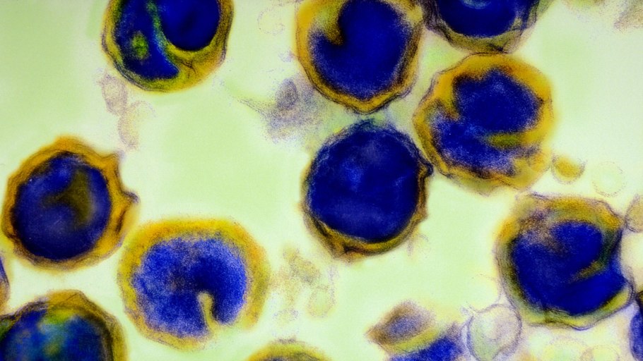 Ацетабулярия водоросль