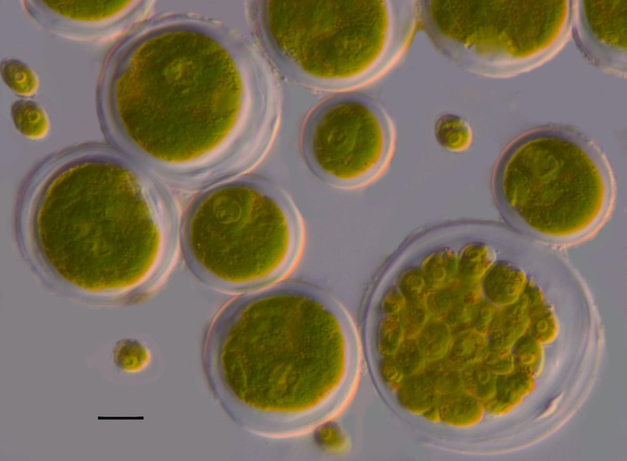 Chlorococcum humicola