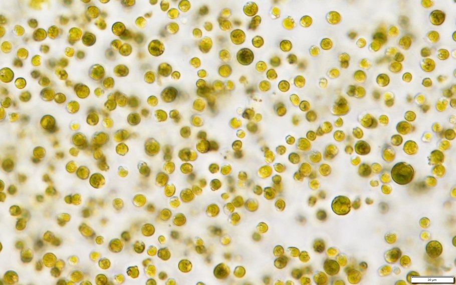 Chlorococcum infusionum