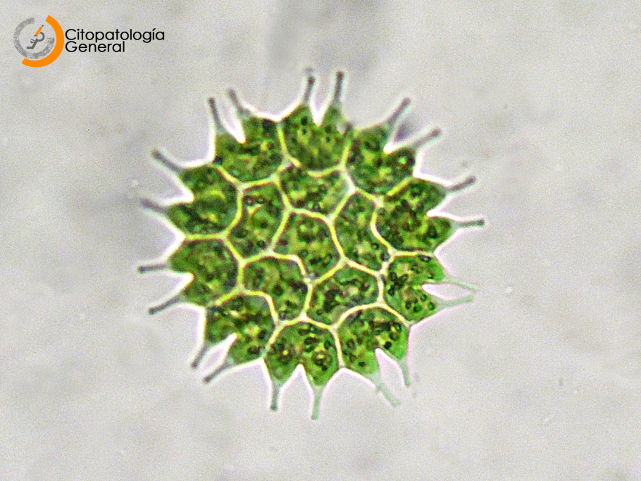 Педиаструм водоросль