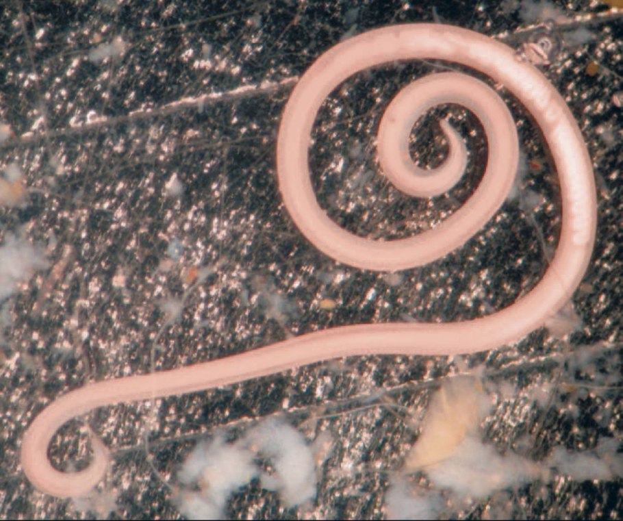 Бактерия Escherichia coli