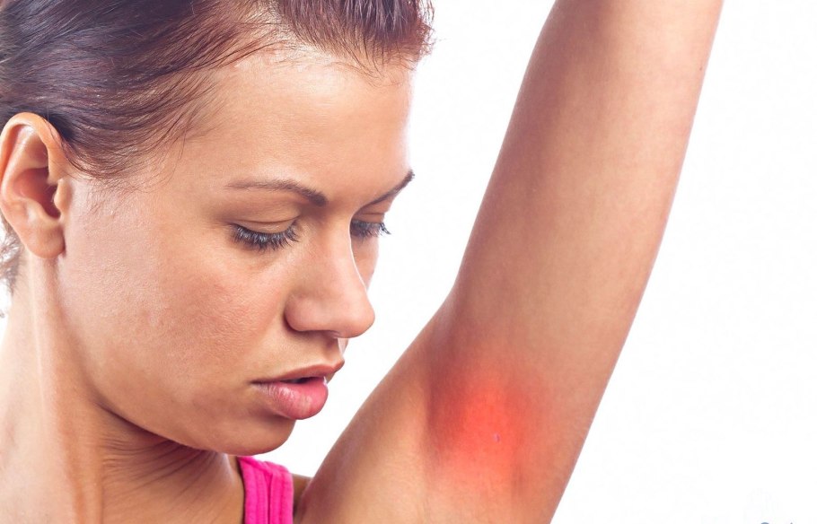 S. aureus золотистый стафилококк