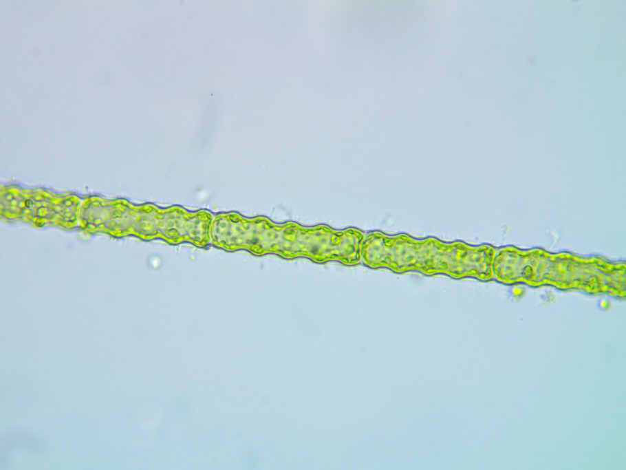 Клетка Oedogonium с колпачками