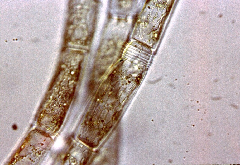 Эдогониевые водоросли