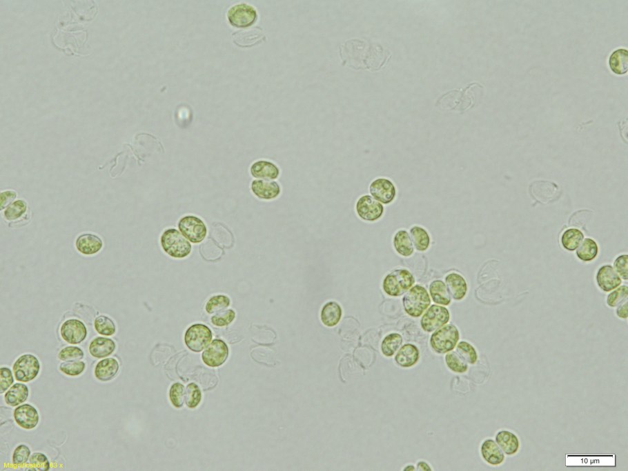 Ретровирусы. Вирус ВИЧ.