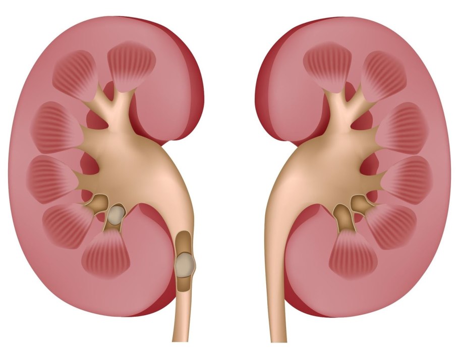 S. aureus золотистый стафилококк