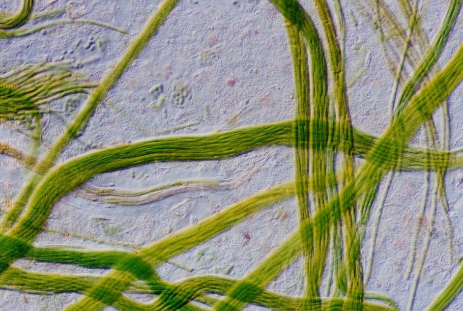 – Anabaena цианобактерия